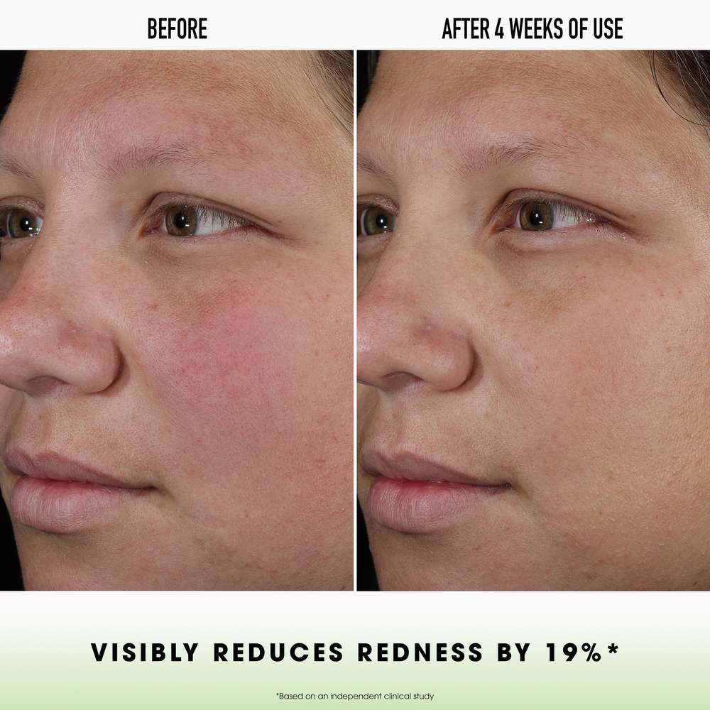 SKINLONGEVITY Hydration Haven Gel Cream - Image 3